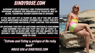 Extreme Anal Fisting & Prolapse At The Rocky Beach Sindy Rose